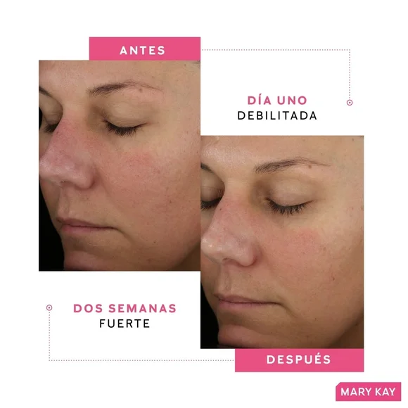 Mary Kay Clinical Solutions Barrer Restore Serum.